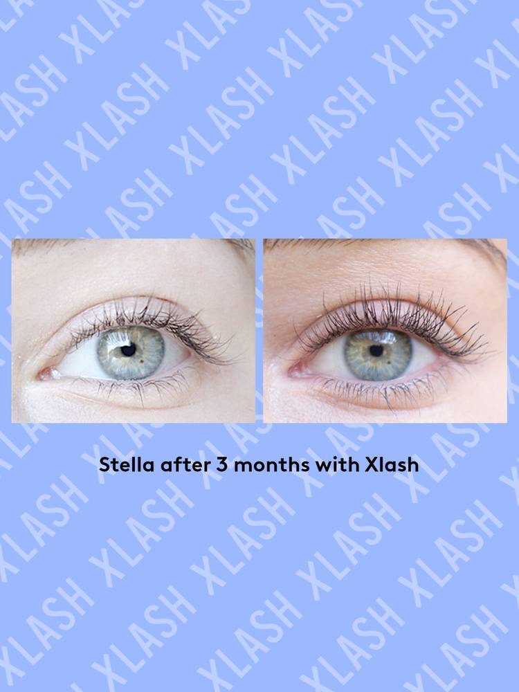 Xlash Eyelash Serum 1ml