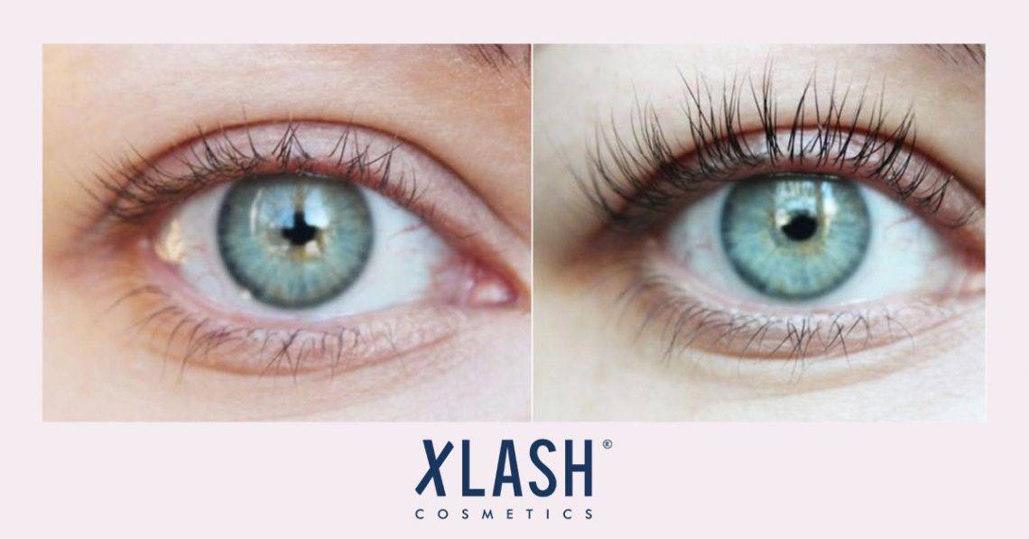 Understanding Your Eyelashes & The Eyelash Growth