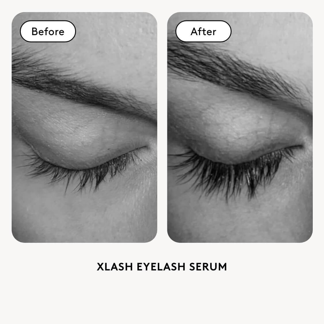 Xlash PRO Eyelash Serum 6ml | Naturally long eyelashes | Xlash