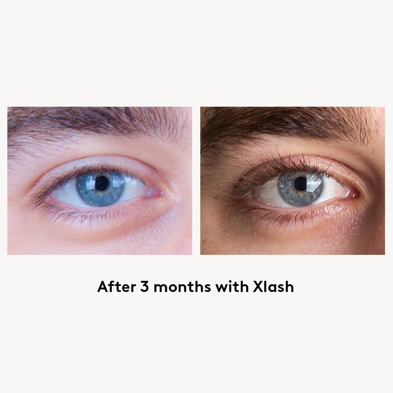 Xlash Eyelash serum and Awakening Eye Gels now in one kit!