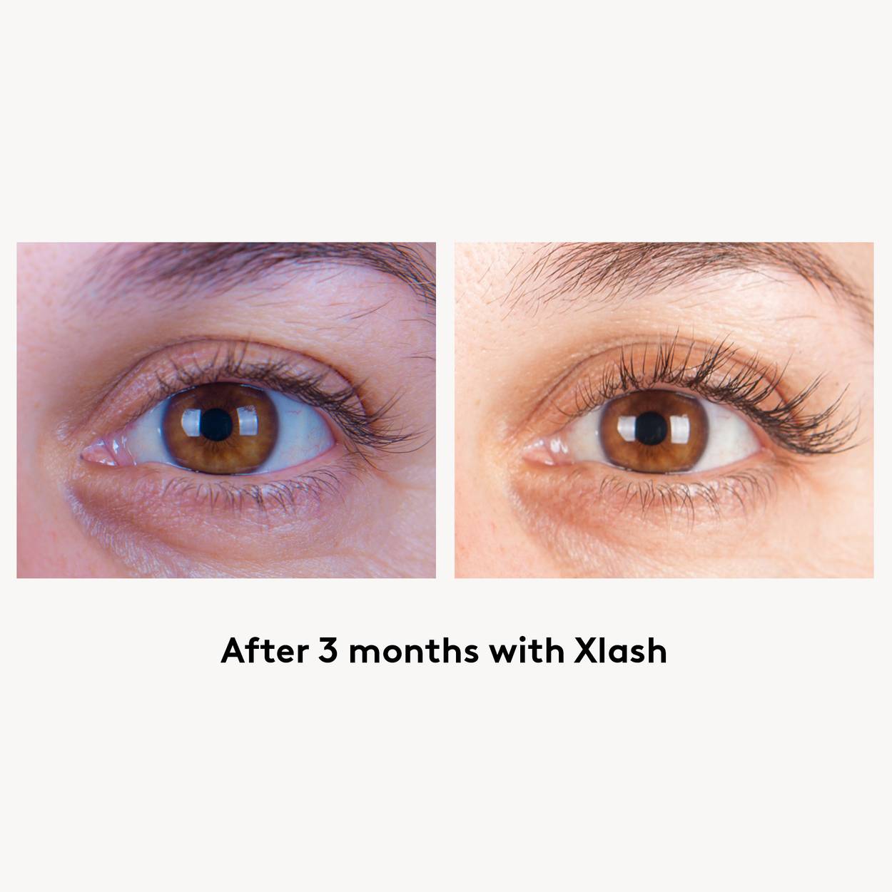 Xlash Eyelash Serum 1ml